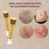 Removedor de Cicatrizes - Image 2